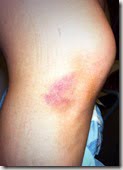 May Seng Yang Terrence Howard ex girlfriend injuries pic