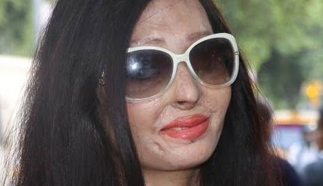 Reshma Qureshi Acid attack Victim Rocks NY Fashion Week